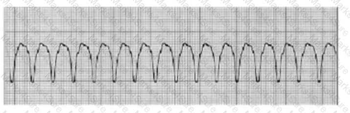 CCRN-Adult Question 27